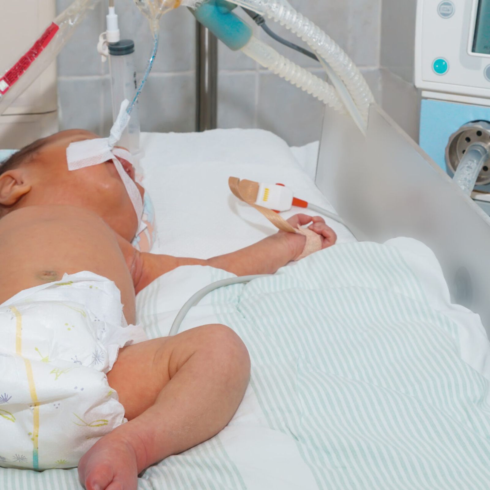 Smart-NeonaTO Project