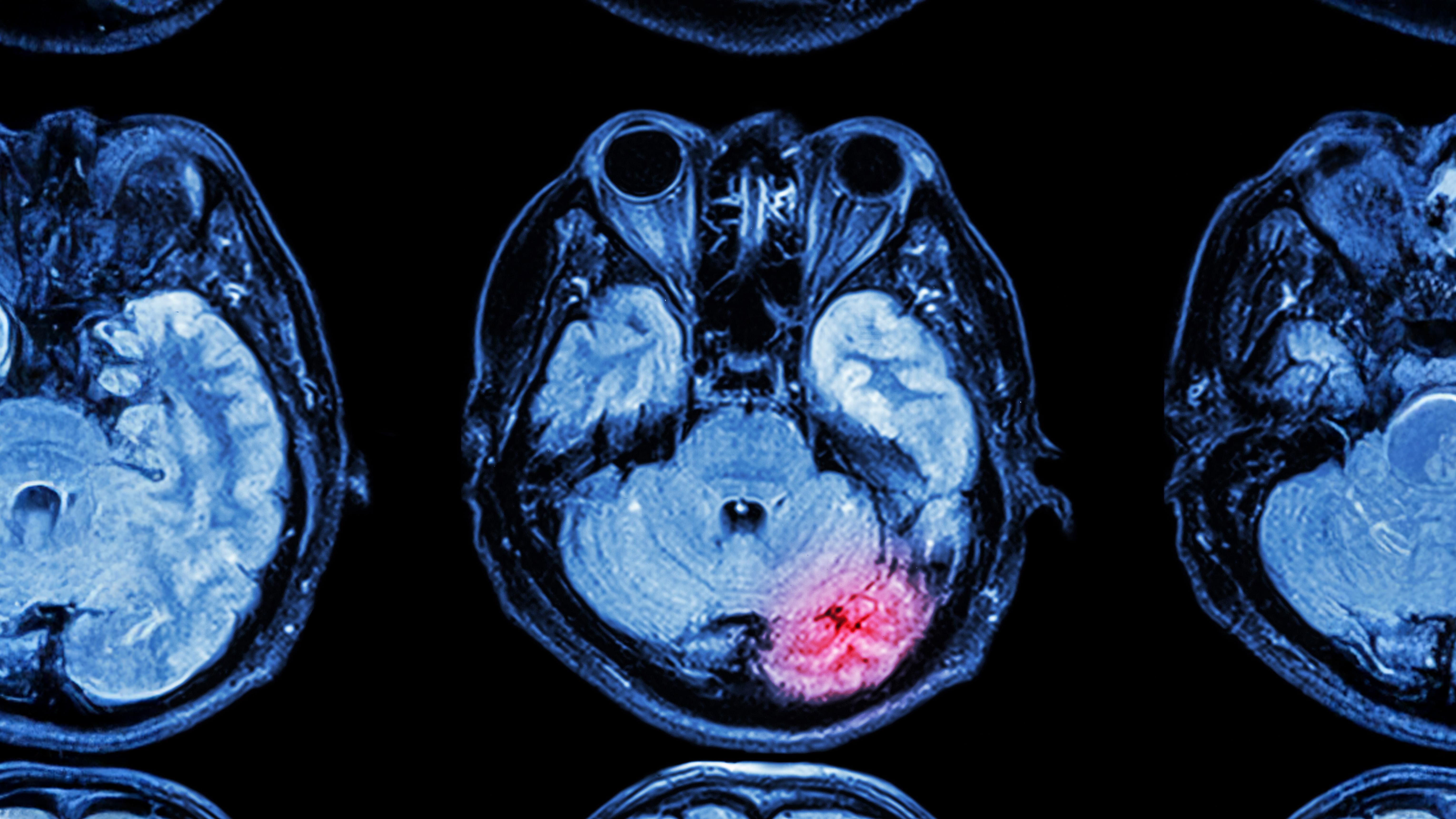 curix-ctscan-wide